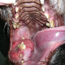 nowotwór w jamie ustnej